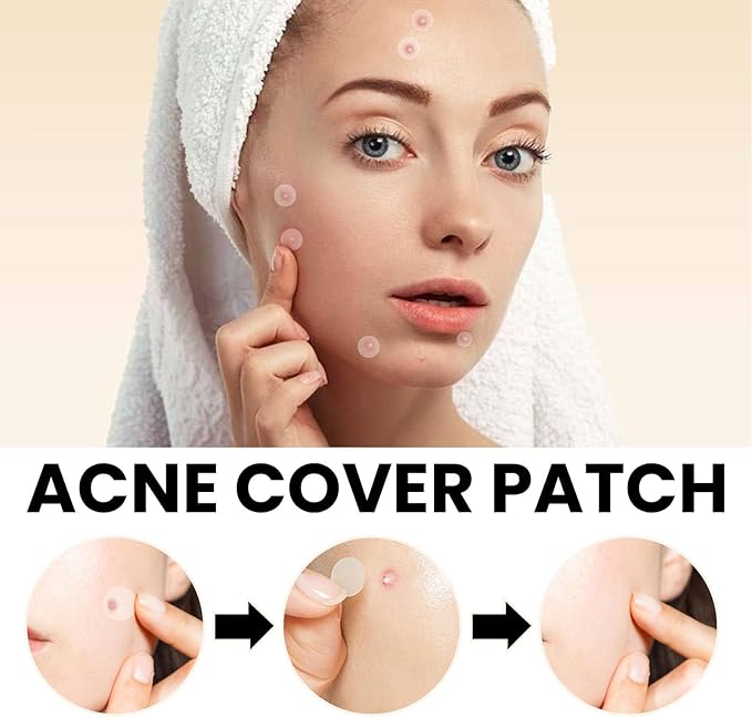 Acne Transparent Cover Patch (72pc)