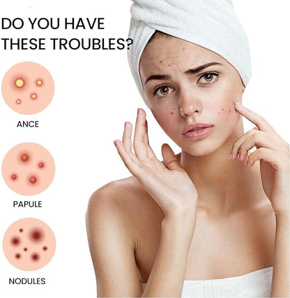 Acne Transparent Cover Patch (72pc)